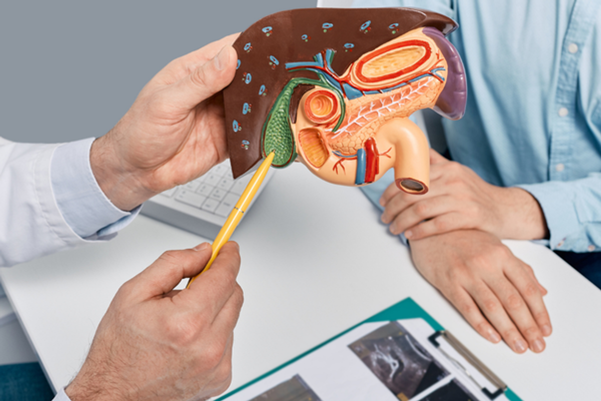 zlucnikove kameny, diagnostika, konzultace, operace zlucniku, klinika iscare zlucnikove kameny, diagnostika, konzultace, operace zlucniku, klinika iscare